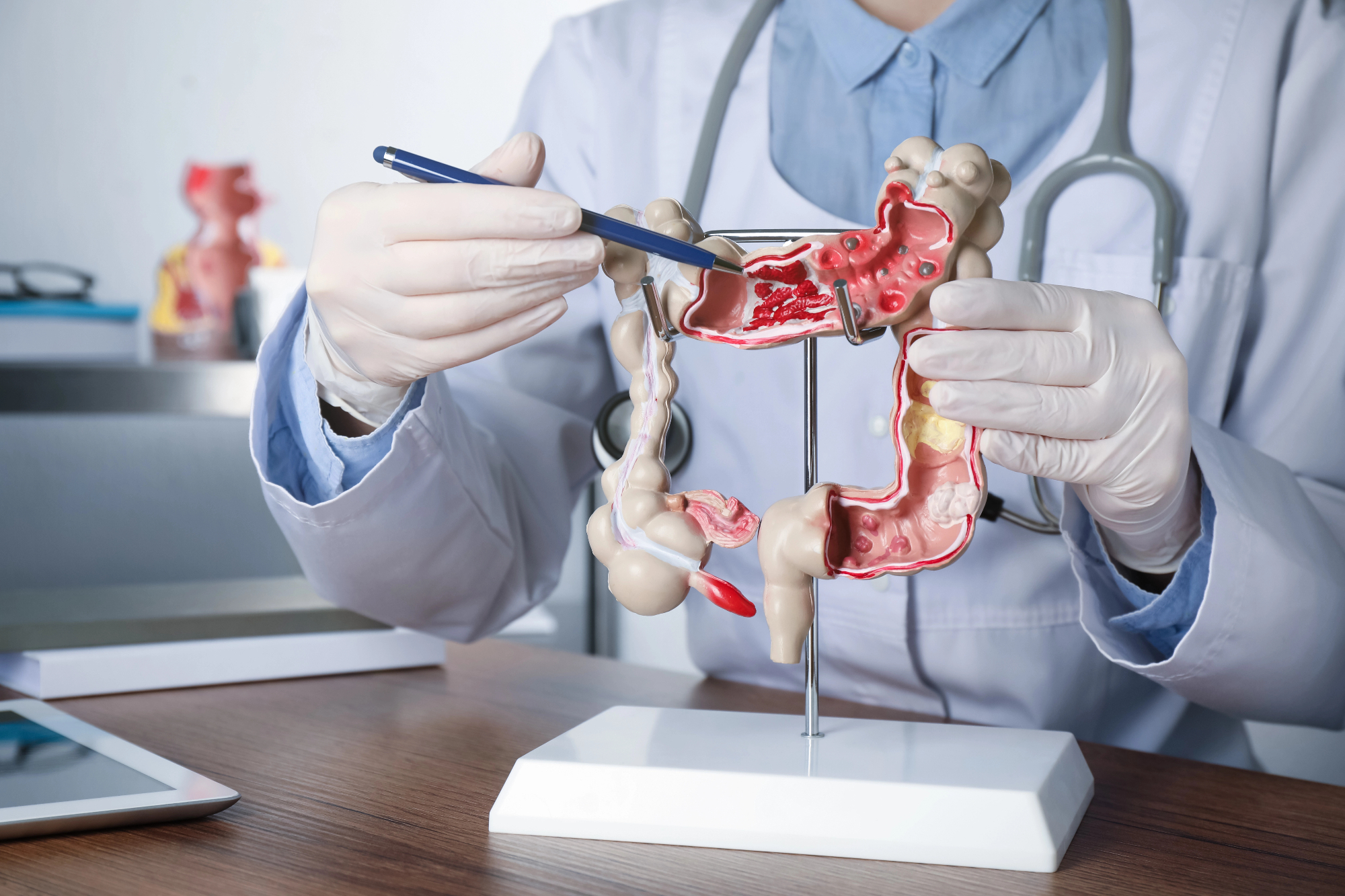 Gastroenterolog je nekaj, za kar sem prvič slišala